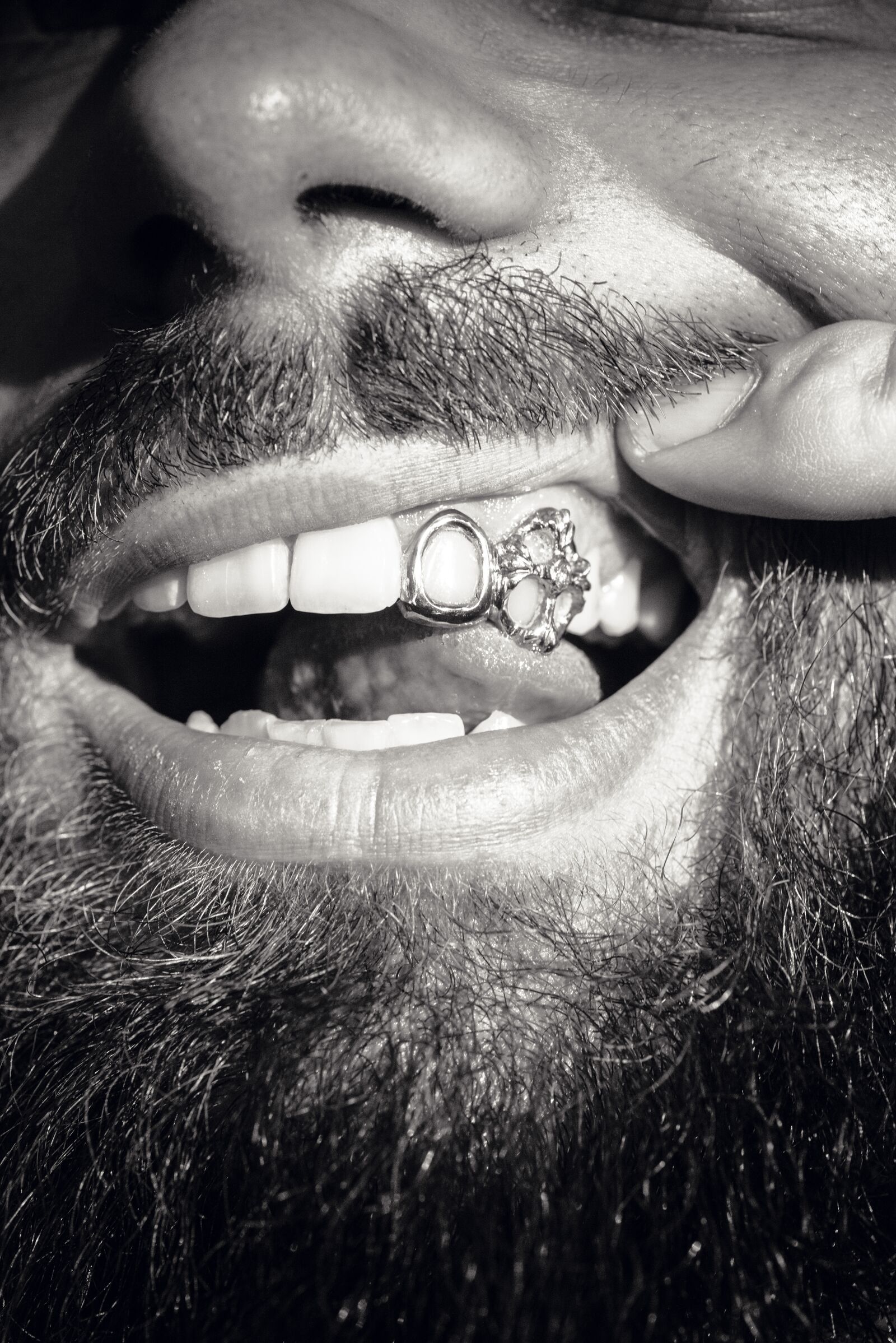 Grillz ajouré en métal précieux porté sur un sourire, photographie noir et blanc en lumière douce